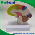MFM002 Hot-Selling High Quality Low Price Anatomical Models Brain